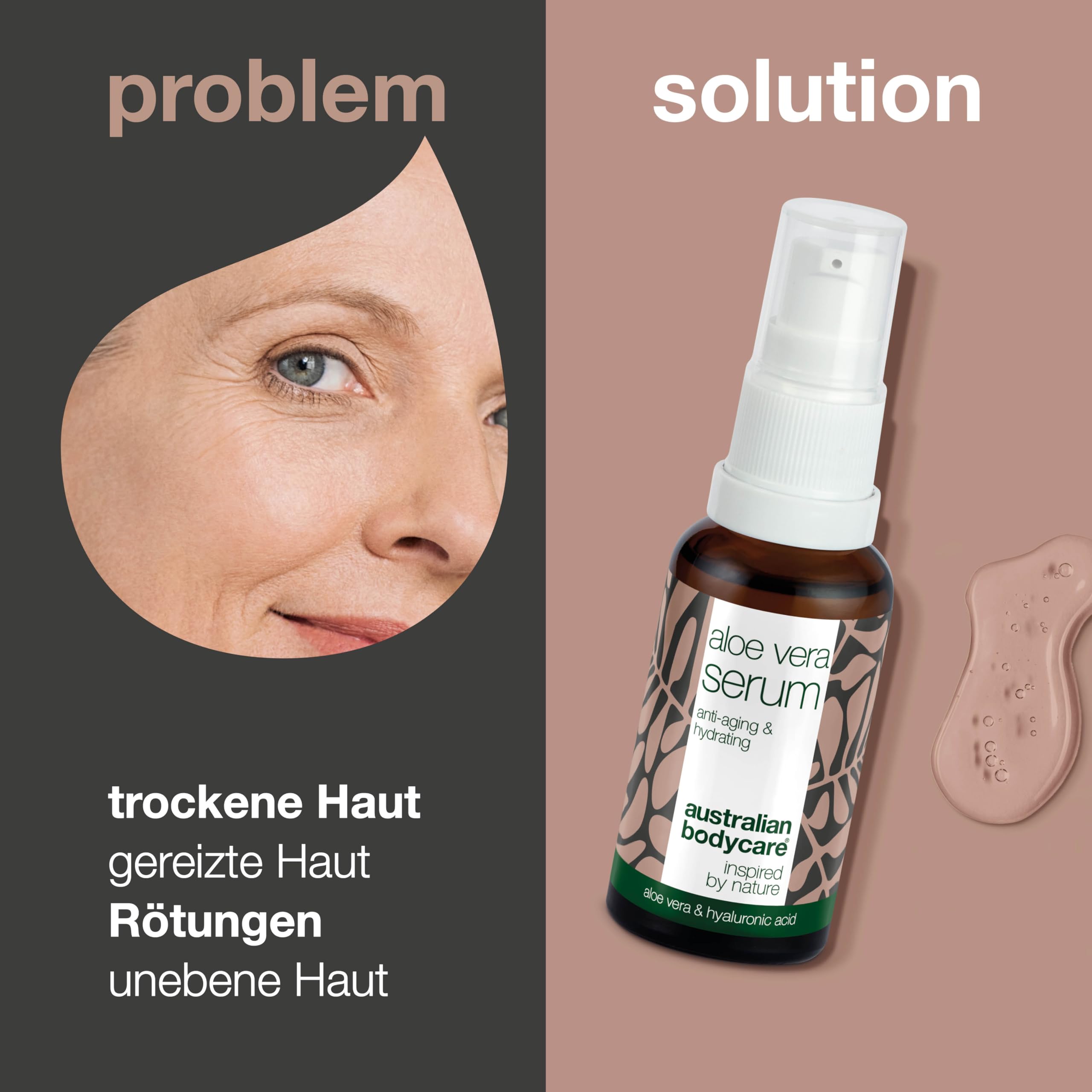 Aloe Vera Serum mit Vitamin C + Hyaluronsure + Vitamin E + Vitamin F |  100% vegan Gesichtsserum pflegt bei Unreinheiten, Pigmentflecken und  Falten/Age | Fr alle Hauttypen geeignet- 30 ml : Amazon.de: Kosmetik