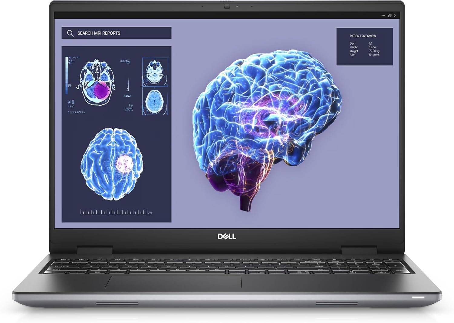 Dell Precision 7680 16" i7-13850HX 64GB RAM 8TB SSD NVIDIA RTX 1000