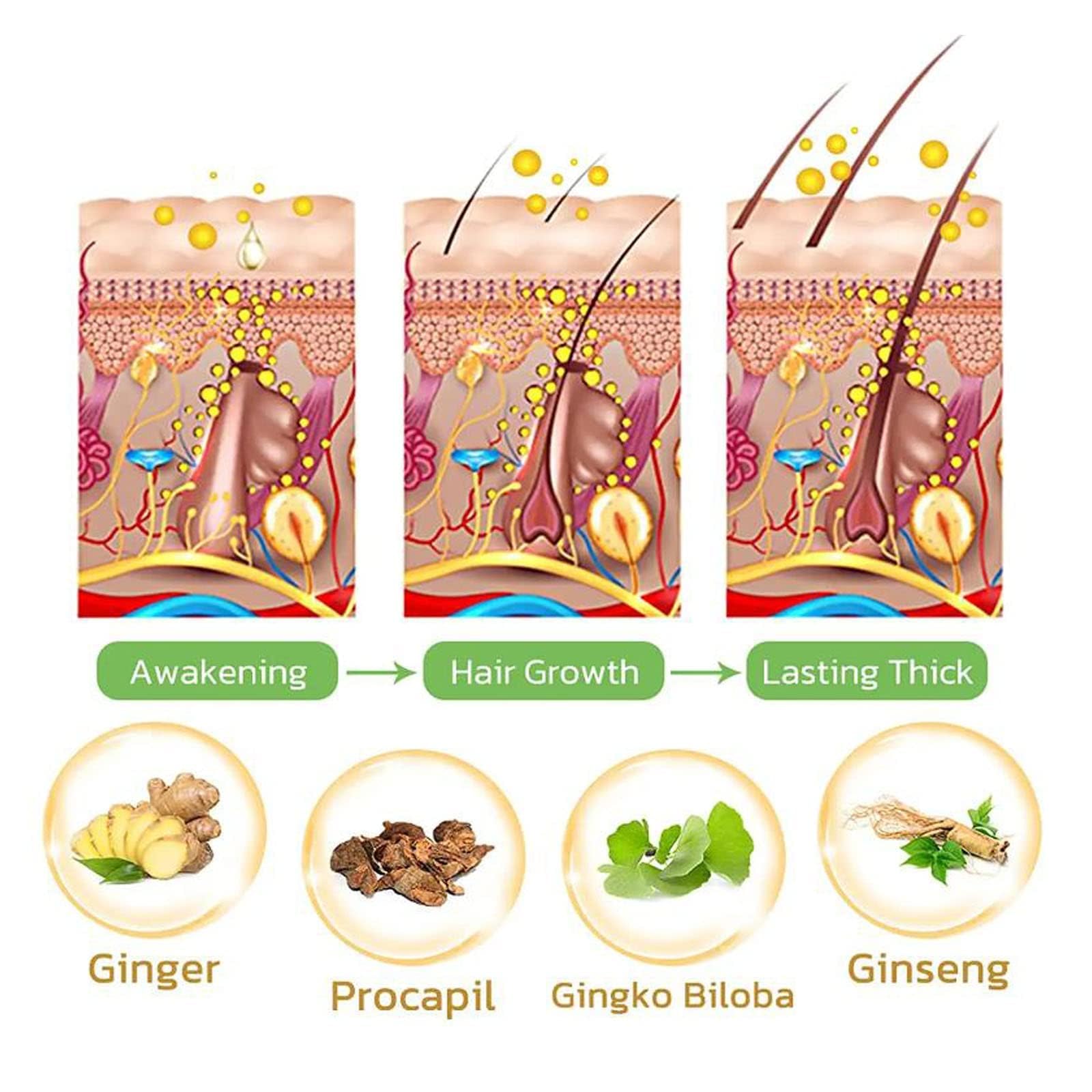 Loción capilar para el crecimiento del cabello, 3 unidades para hombres y mujeres, mejora N3, Growthplus Nourishing Ginger Spray, Hair Lotion Hair Root Hair Beard with Roller, Hair Lotion Herbs