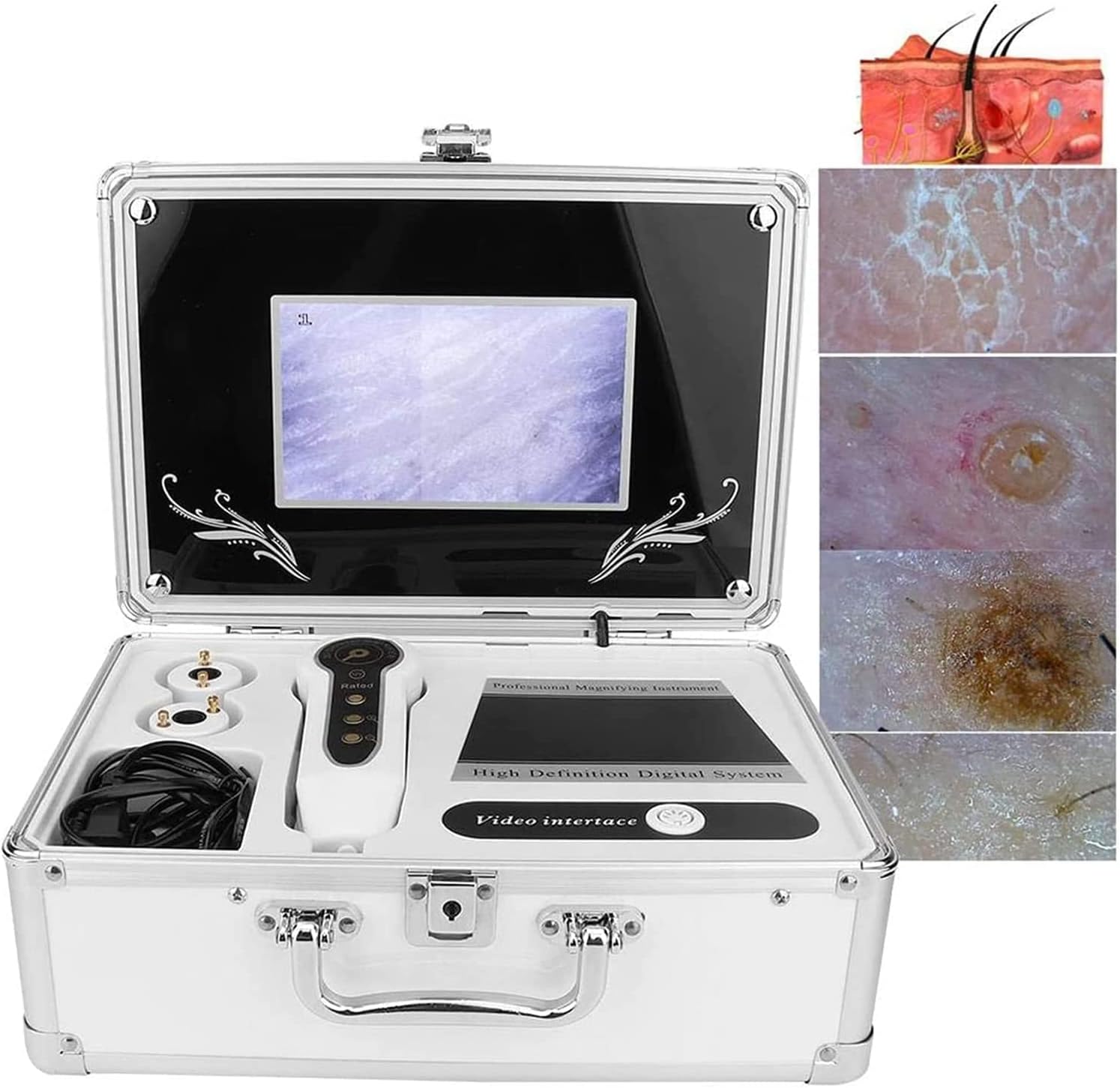 50x/200x Skin, Hair, and Scalp Analyzer; 7-inch LCD Screen Professional Scanning Skin Care and Hair Analyzer Suitable for Salon/Home Use.