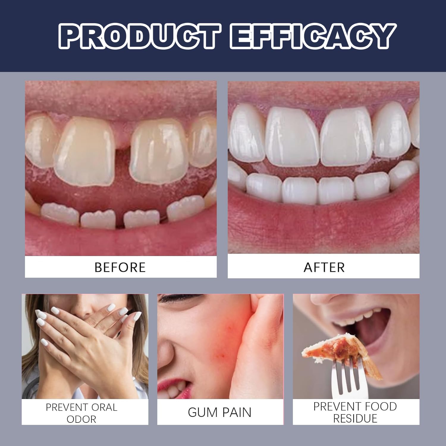 Thermoplastic Denture Adhesive, Extra Strong and Durable Denture Adhesive, Refits and Tightens Loose Upper and Lower Dentures and Partials, Can Last Up to 4 Days, Suitable for All Ages (40g)