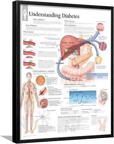AllPosters Póster de pared para entender la diabetes, gráfico educativo sobre marco negro, 22 x 28 pulgadas