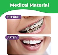 Vista 4 de Bandas de goma elásticas ortodónticas de 5/16 pulgadas, paquete de 100, neón, tamaño mediano, 3.5 onzas, bandas de goma pequeñas para rastas