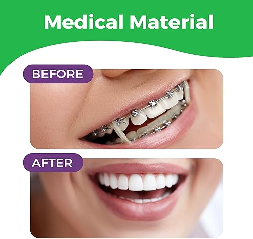 Miniatura 7 de Bandas de goma elásticas ortodónticas de 516 pulgadas, paquete de 100, naturales, pesadas de 4.5 onzas, pequeñas bandas de goma para rastas para el