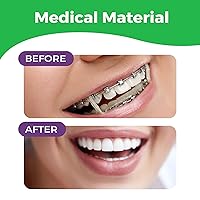 Vista 5 de Bandas de goma de ortodoncia para aparatos ortopédicos – Bandas elásticas de goma de dientes de alta calidad para aparatos ortopédicos, arreglar