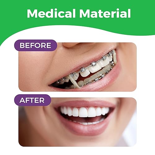 Miniatura 5 de Bandas de goma elásticas ortodónticas de 316 pulgadas, paquete de 300 unidades, neón, pesado 4.5 onzas, pequeñas rastas para el cabello fijan el