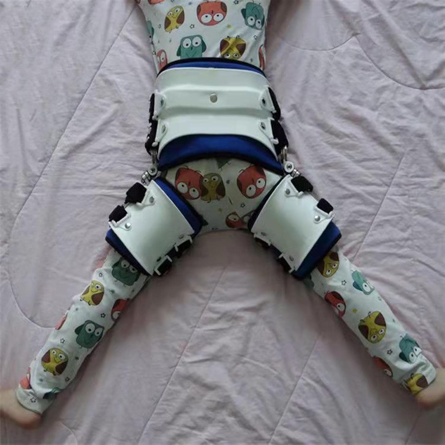 Hip Abduction Brace, Children's Hip Joint Dislocation of Hip Abduction Orthosis Suitable for Patients with Hip Dysplasia and Skeletal Deformities,A,M