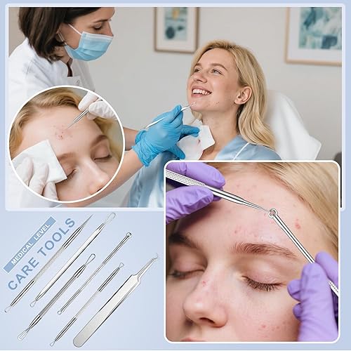 Miniatura 5 de Kit de herramientas para quitar puntos negros, juego de 6 piezas de extractor de espinillas de acero inoxidable con pinzas, garantía de reemplazo de