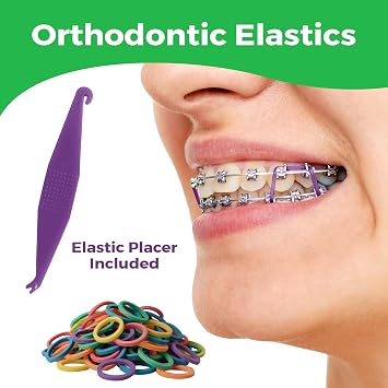 Orthodontic Rubber Bands for Braces 1/4 Medium Force 3.5 oz - 100 Pack, Neon, Elastic Braces Rubber Bands, Orthodontic Elastics for Fixing Tooth Gaps, Dreadlocks, Includes Free Elastic Placer