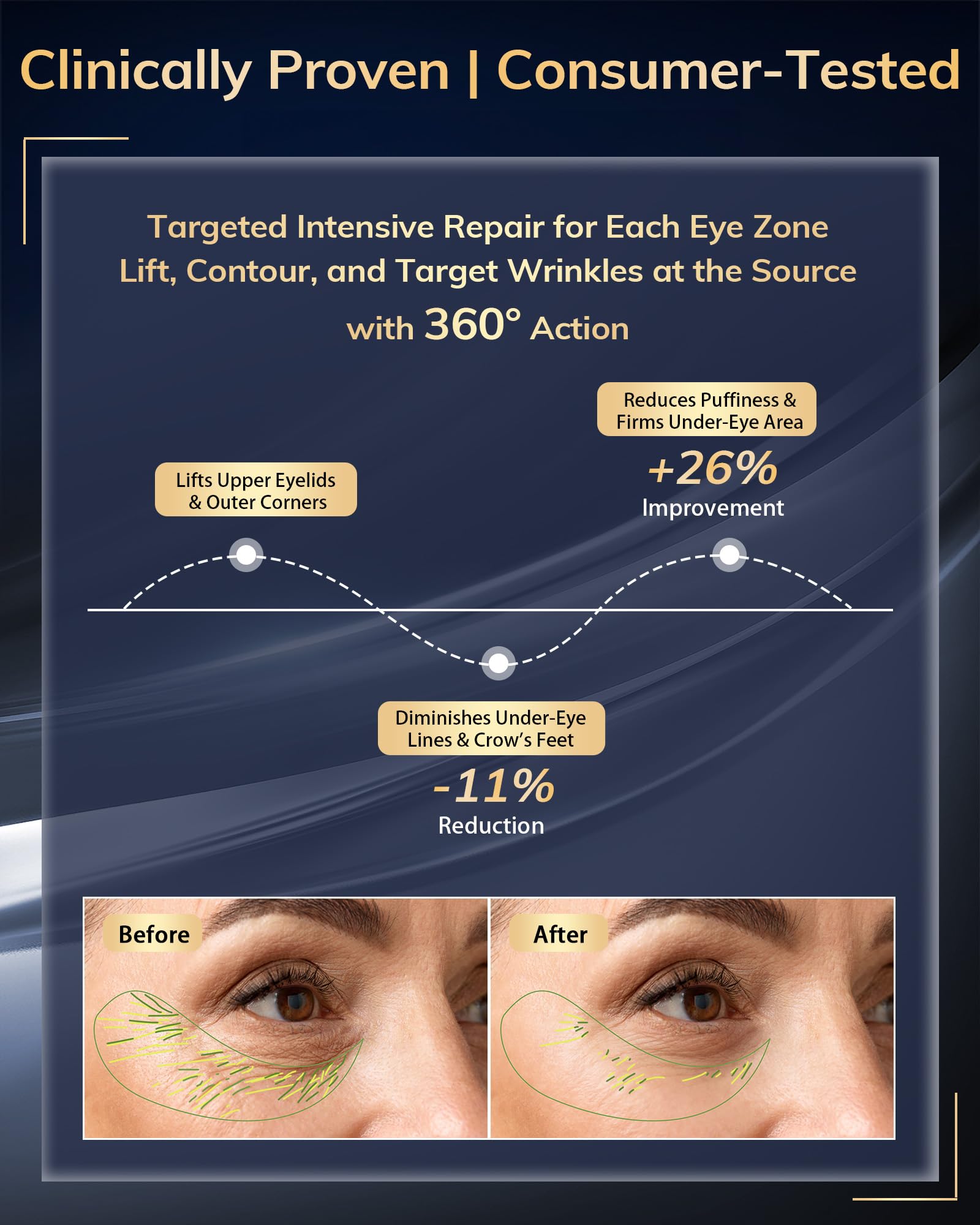 Dispositivo de terapia de luz roja debajo de los ojos, gafas de terapia de luz roja para ojos rojos 650 NM, máscara de ojos de luz roja para el tratamiento de bolsas de ojos, ojeras, hinchazón