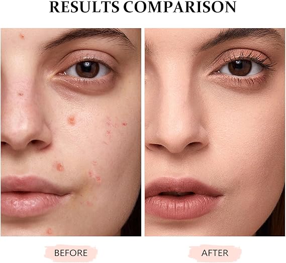 Concealer Full Coverage for Mature Skin - Eye Concealer Concealer Full Coverage Lasting Perfection Concealer for All Skin (#Honey, 12ml)