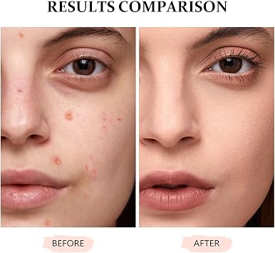 Concealer Full Coverage for Mature Skin - Eye Concealer Concealer Full Coverage Lasting Perfection Concealer for All Skin (#Honey, 12ml)
