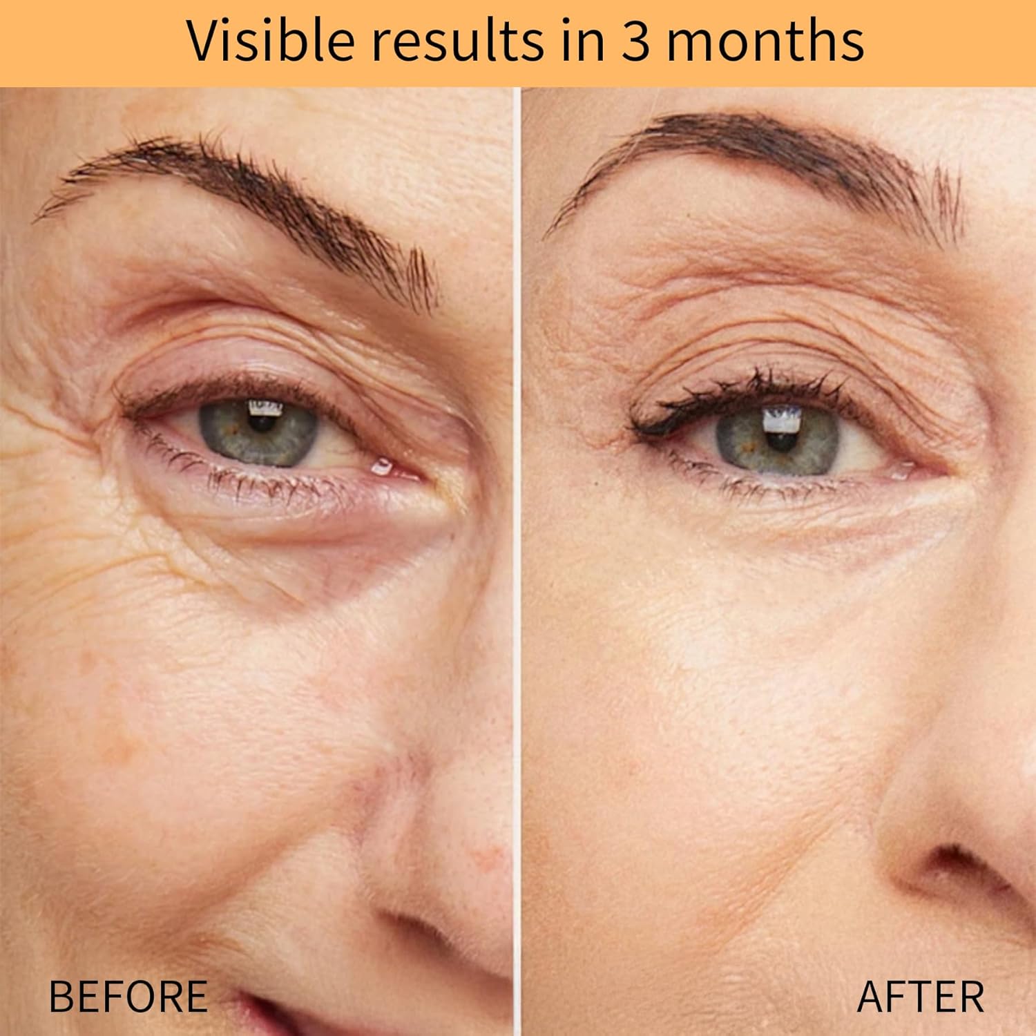 QINGLIN Polypeptide Tightening Anti-Wrinkle Cream, Firming and Smoothing Face Moisturizer, Lift & Hydrate Full Face for Youthful Skin - Image 5