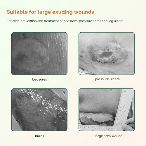 Miniatura 6 de Apósito de Espuma Sacro con Borde - Adhesivo de Silicona 7"x7" Impermeable Apósito Sacro para Heridas - Almohadillas de Alta Absorción Transpirables