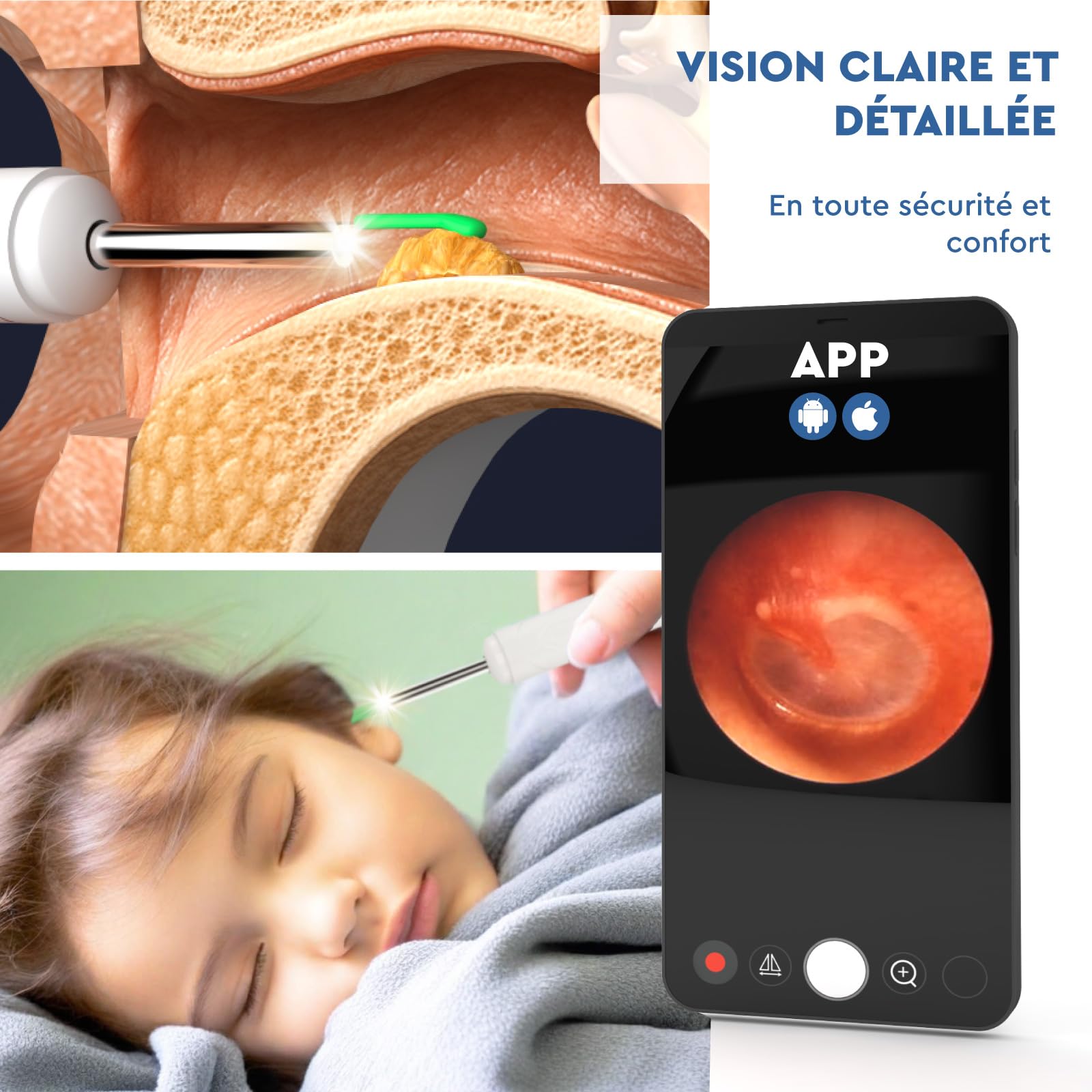Otoscope Oreille avec Caméra 1920p 3,6mm Étanche WiFi Elimination du Cérumen - UdiGuard Endoscope Nettoyant Oreille Blanc 6 Lumières LED Animaux Adultes Enfants - Compatible avec iPhone iPad Android