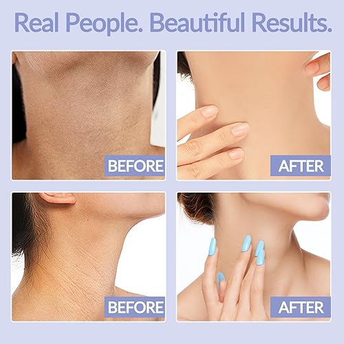 Miniatura 5 de Crema reafirmante para el cuello, crema para apretar y levantar el cuello, cremas para el cuello antienvejecimiento para tensar la piel flácida e