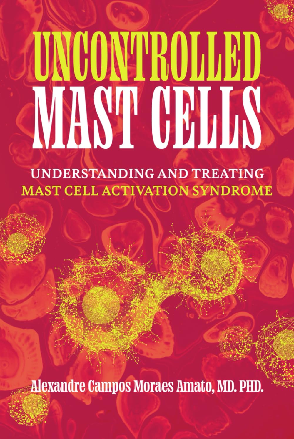 Uncontrolled Mast Cells: Understanding and Treating Mast Cell Activation Syndrome (The Lipedema Journey)