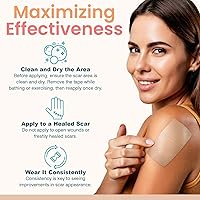 Vista 5 de Cinta de silicona prémium para cicatrices quirúrgicas, hojas de cicatrices de silicona reutilizables y profesionales, cinta médica para queloides