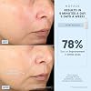 NuFACE FDA Cleared Effective Lip & Eye Attachment for TRINITY+ Microcurrent Facial Device - At Home Eye & Smile Lines Treatment to Tighten Hard-to-Reach Areas Around Mouth and Eyes