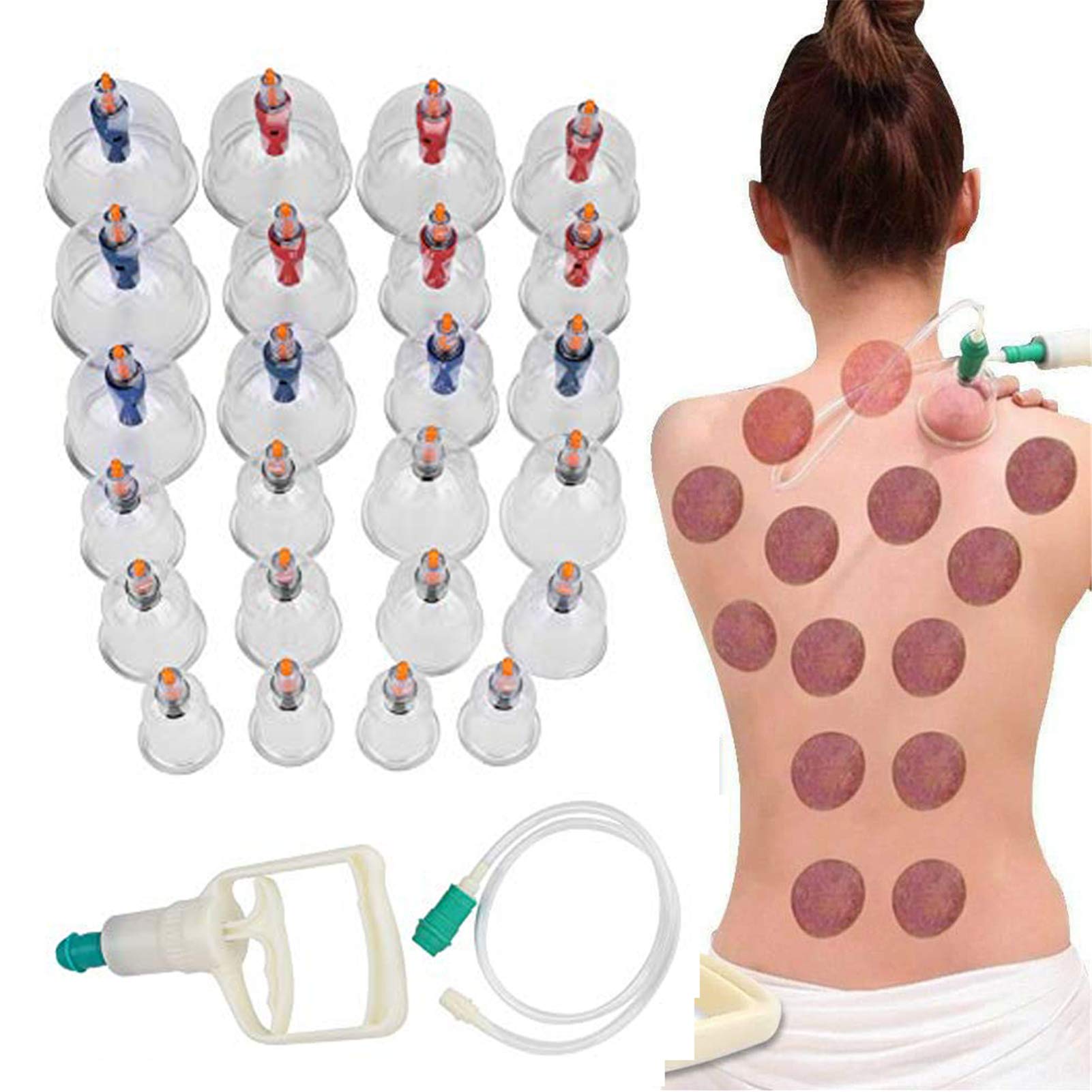 Schröpftherapie-Set, 24 Vakuum-Luftsaugnäpfe mit Pumpgriff, Vakuum-Schröpfset, Massagetherapie-Schröpfbecher, Anti-Cellulite-Körper, für Rücken-/Nackenschmerzen, Gewichtsverlust, Muskelentlastung