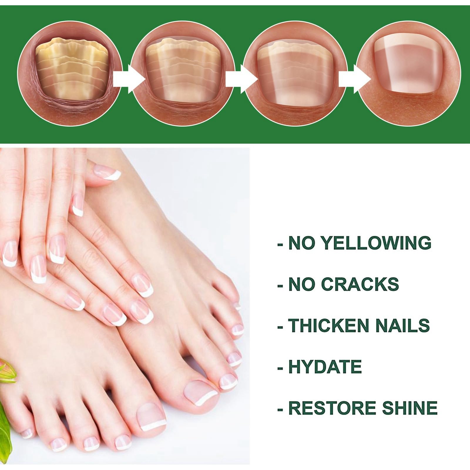 2pcs Radiant Nail Growth Oil,Radiant Nail Growth Oil Pen,Cuticle Oil Pen for Nails,Nail Growth Pen,Nail Growth Serum,Nail Strengthener Oil,Nail Nutrient Oil Pen,Cuticle Care Oils,Nail Nutrient Oil Pen - Image 3