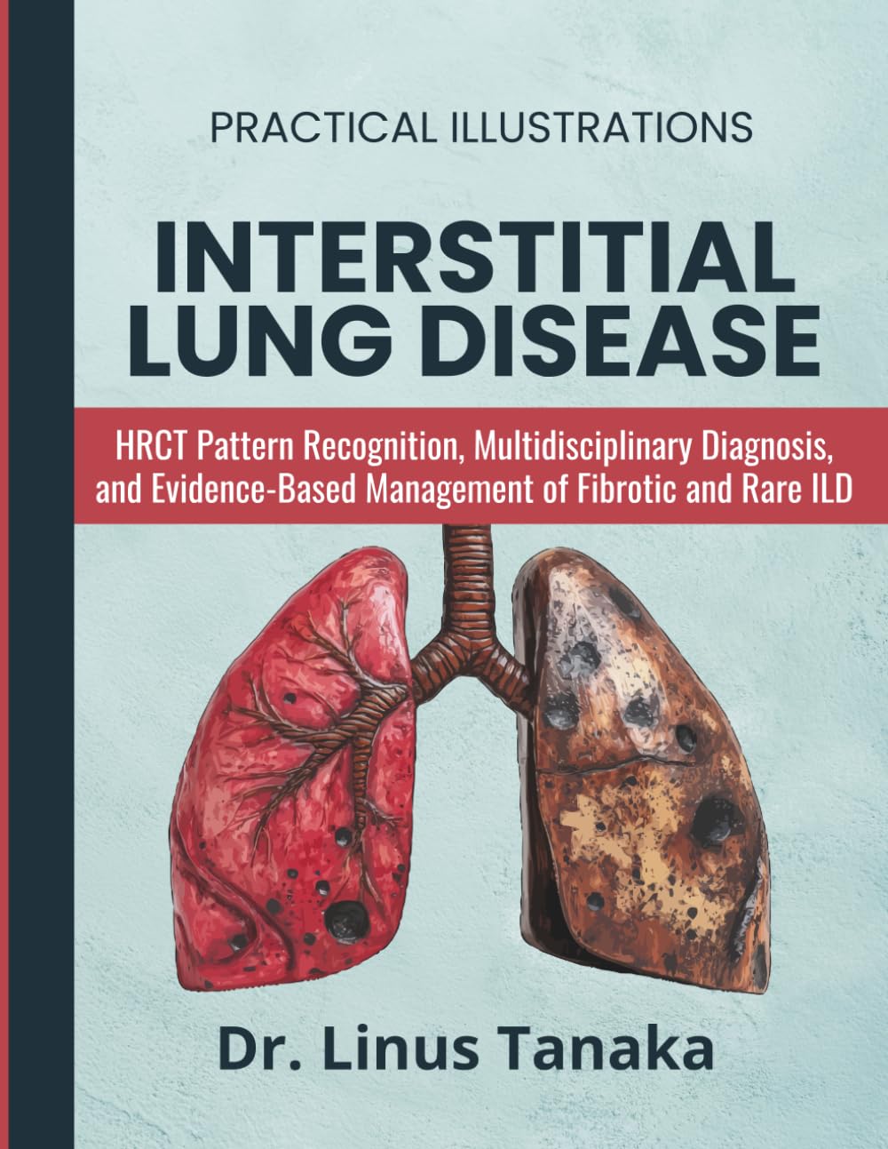 Interstitial Lung Disease Manual: HRCT Pattern Recognition, Multidisciplinary Diagnosis, and Evidence-Based Management of Fibrotic and Rare ILD