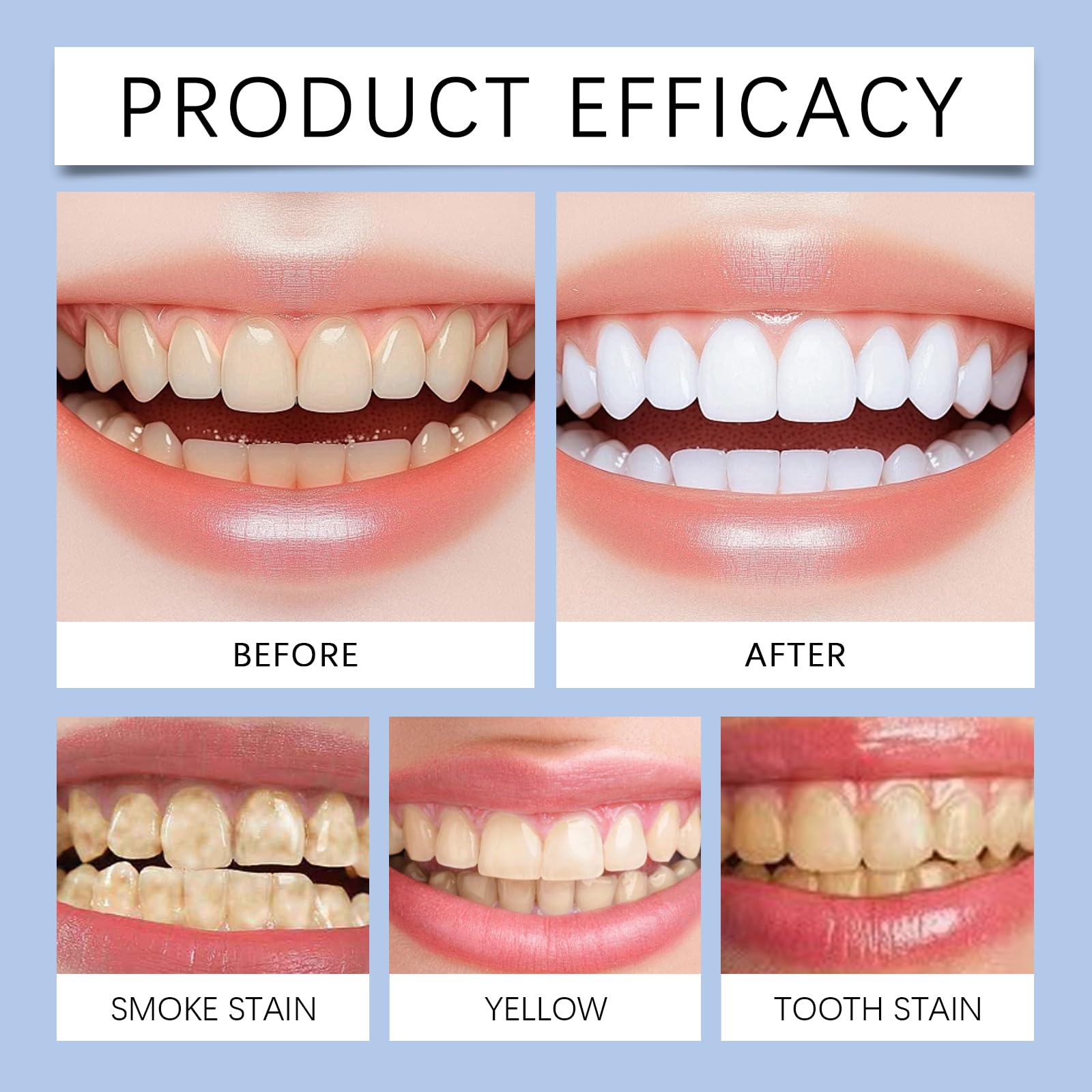 Dentifricio sbiancante con niacinamide, dentifricio rigenerante per gengive e smalto, naturale e delicato per alito fresco, denti brillanti, rimuove le macchie, senza fluoruro (4)