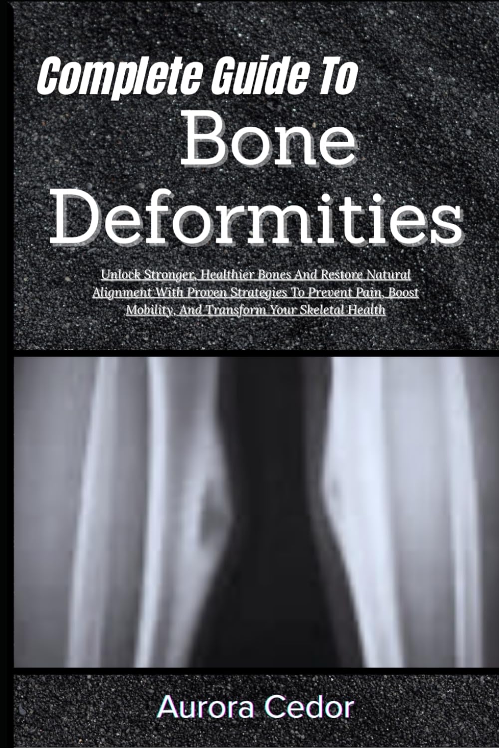 Complete Guide To Bone Deformities: Unlock Stronger, Healthier Bones And Restore Natural Alignment With Proven Strategies To Prevent Pain, Boost Mobility, And Transform Your Skeletal Health