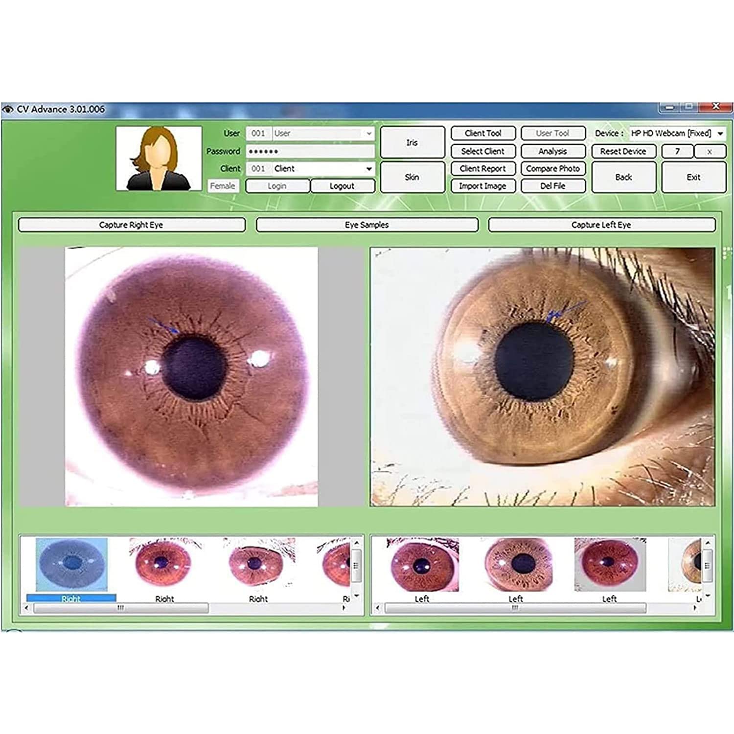 Amazon.co.jp: 虹彩分析カメラ、目の虹彩カメラ虹彩検出器オート