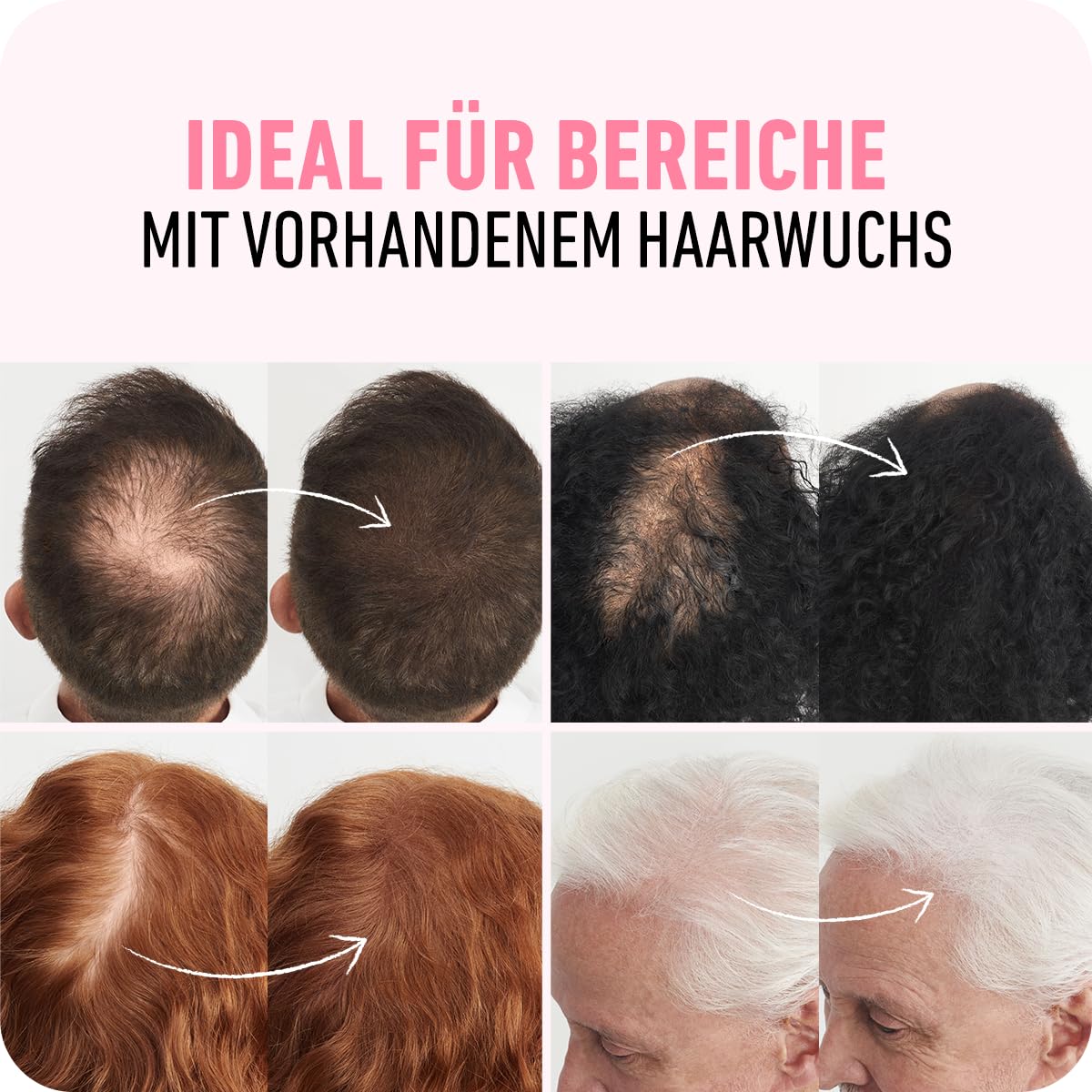 BOLDIFY Haarfasern für dünner werdendes Haar, für Damen & Herren, Dunkelblond 56g