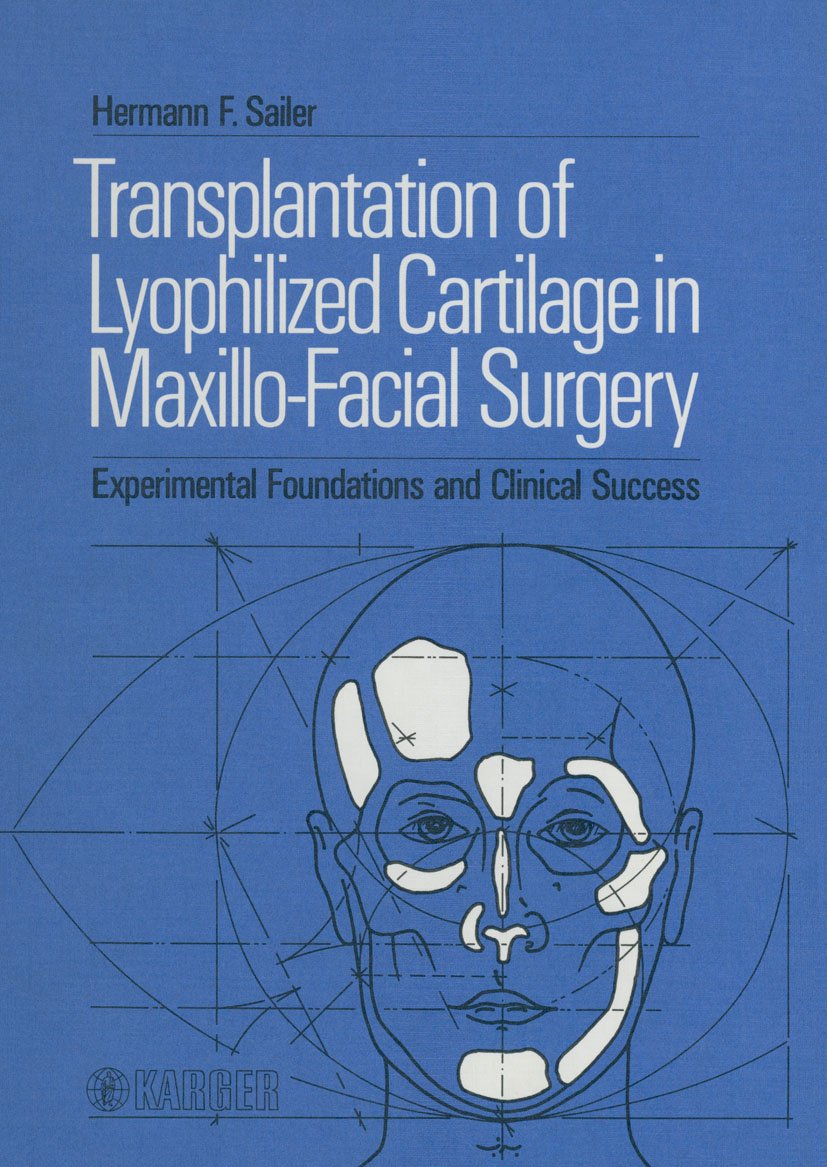 Transplantation of Lyophilized Cartilage in Maxillo-Facial Surgery: Experimental Foundations and Clinical Success      [Print Replica] Kindle Edition