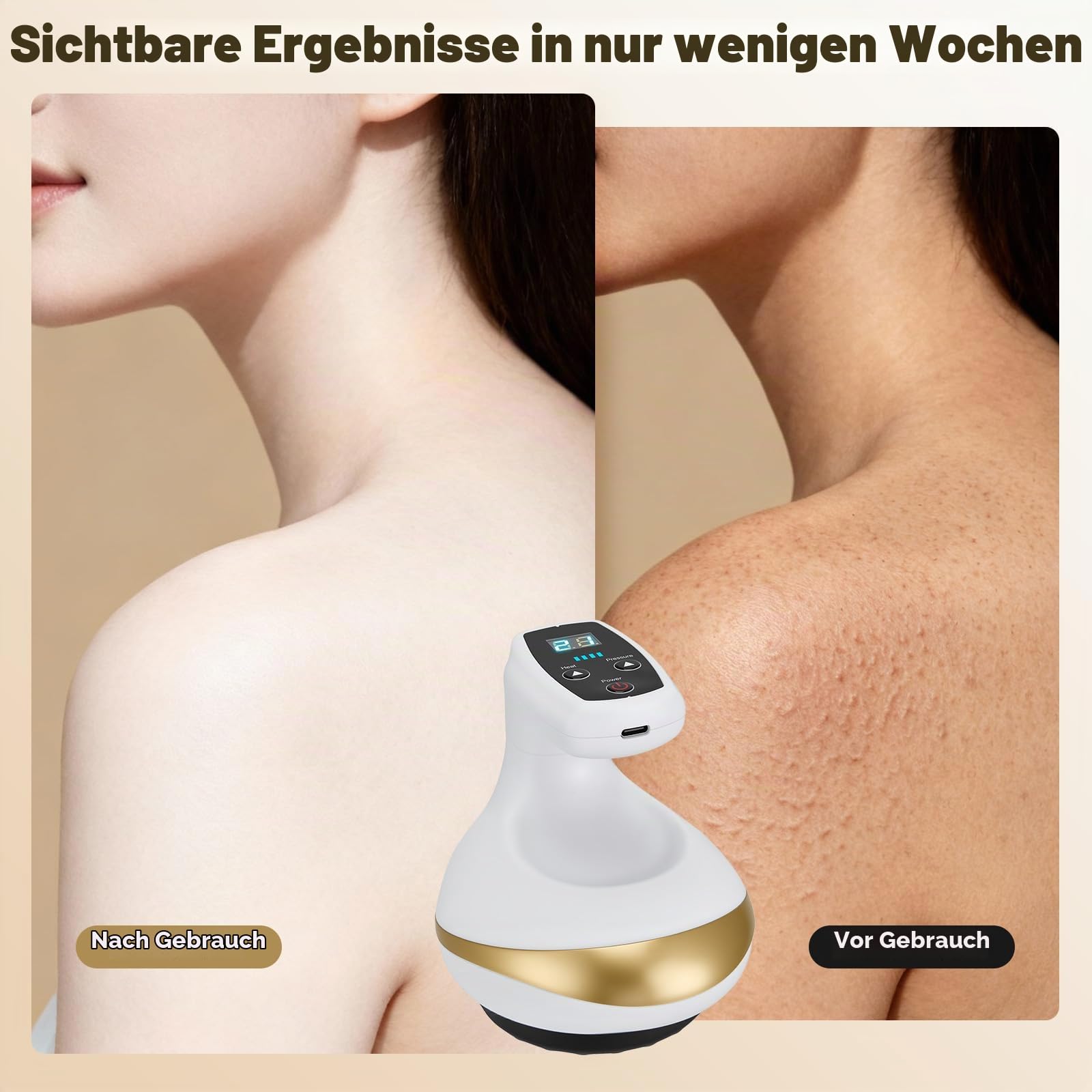 Schröpfgerät Elektrisch, Vakuum Massagegerät Gegen Cellulite