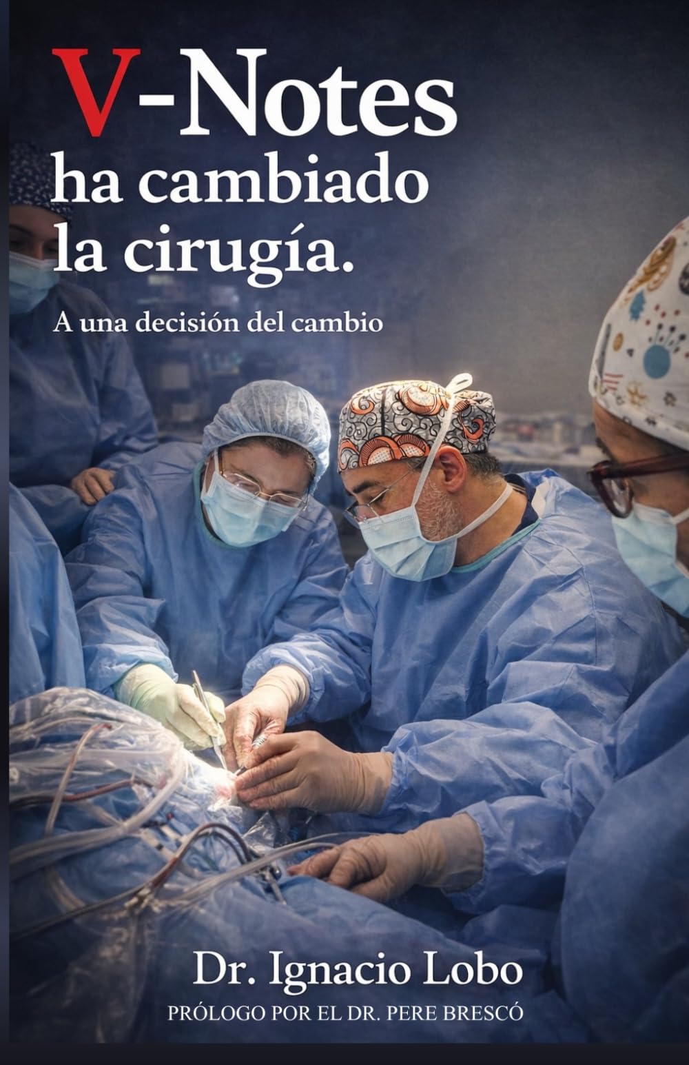 V-notes ha cambiado la cirugía.: A una decisión del cambio