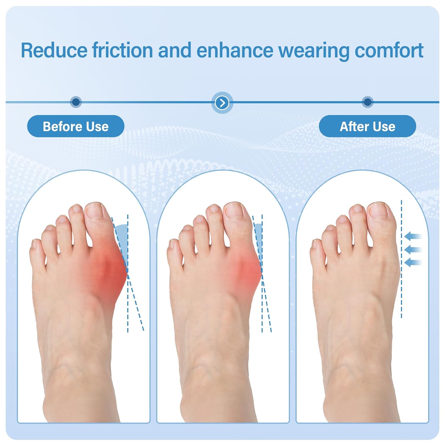 Bunion Corrector for Women & Men, [2-Pack] Comfortable Hallux Valgus Relief Splint, Discreet Soft Toe Straightener for Fits in Shoes, Adjustable Alignment Support for Day and Night