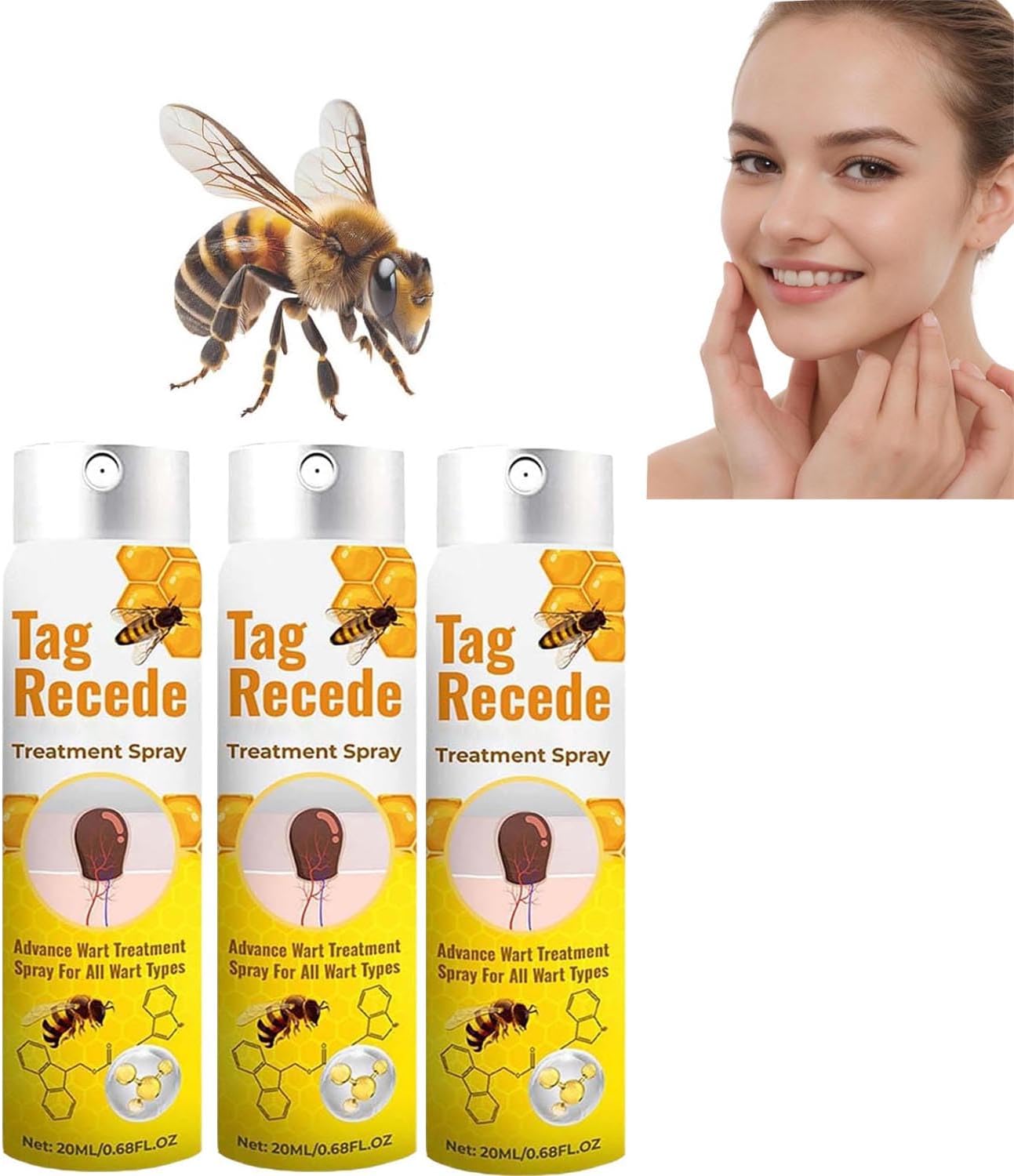 Can Bee Venom Remove Skin Tags Tag Recede Bee Venom,Tag Recede Bee Venom Spray,Wart Removal Spray Skin