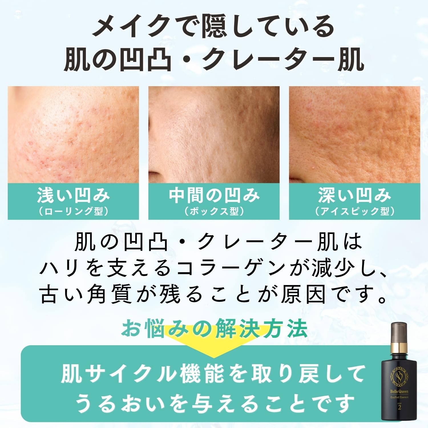 美容液 Belle Queen ExoPeel Essence Amazon.co.jp: BellQueen Exopil Skin Care Serum (For Wrinkles