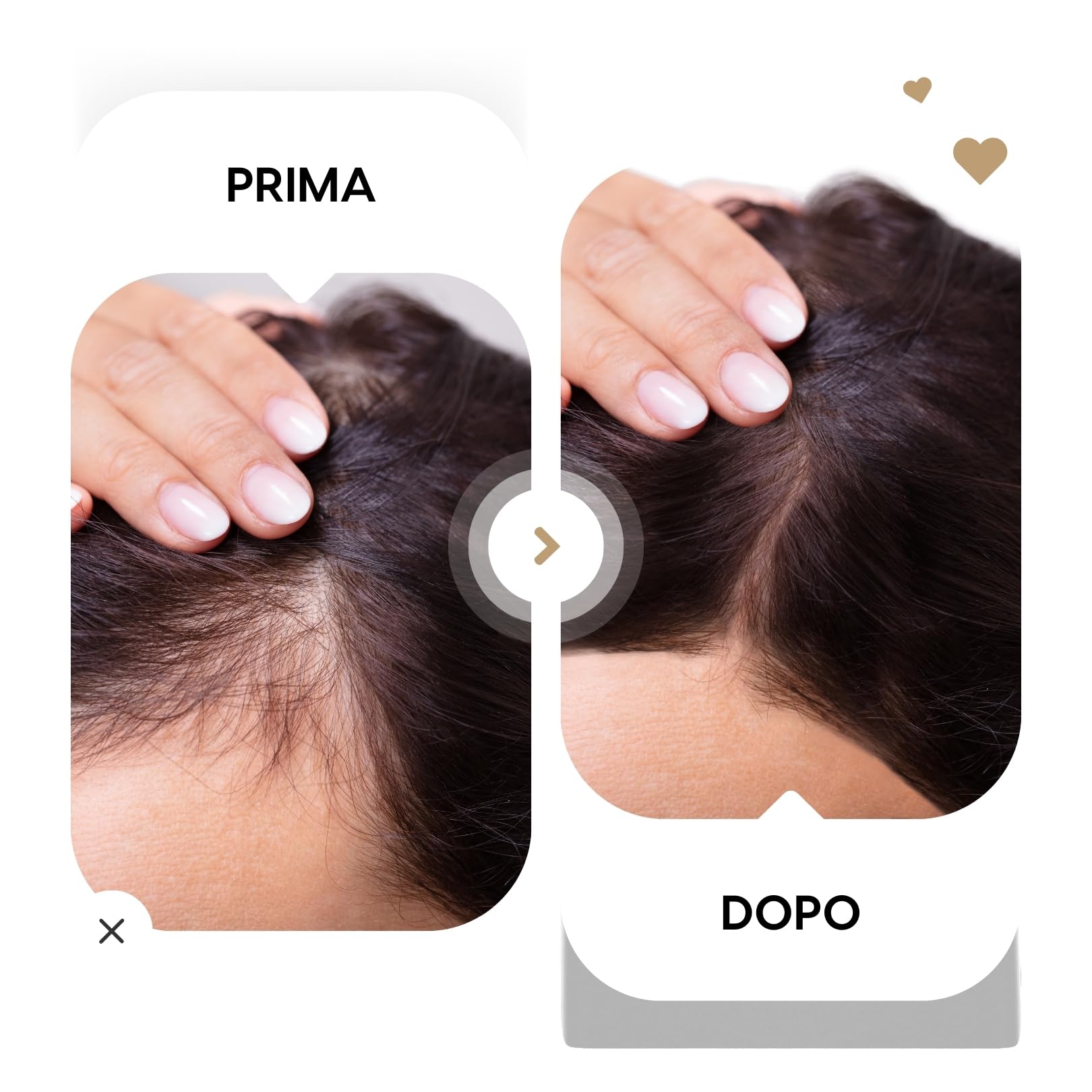 Kerargan - Lozione Tonica con Olio di Ricino Anti-Caduta per Capelli Fortificati - Idratante, Districante, Volume e Anti-Crespo - Senza Solfati, OGM né Oli Minerali - 250ml