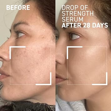 Dr. Brandt Drop of Strength All-Day Strengthening Serum - Enhances Skin Resilience & Provides Instant Hydration - 1.0 fl oz