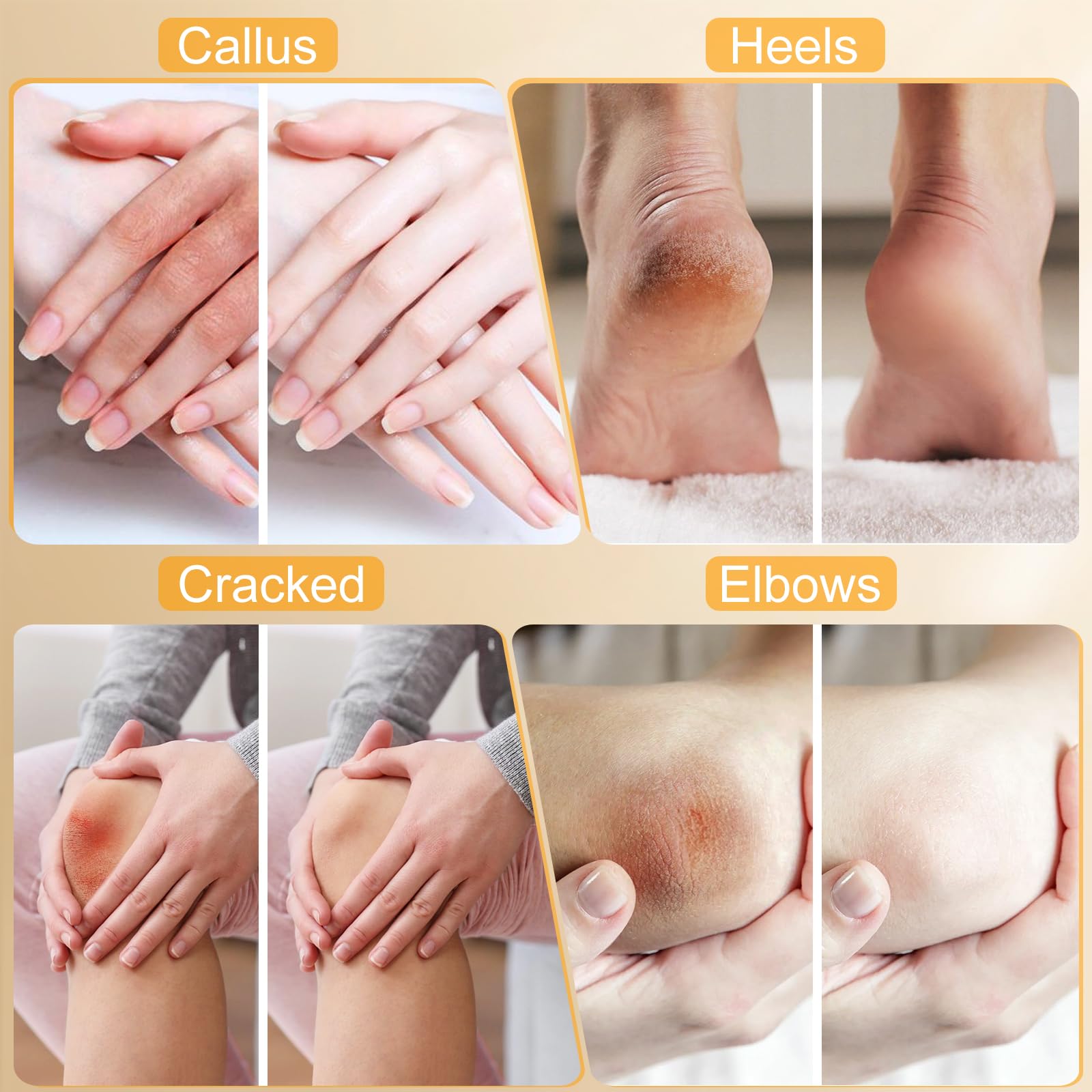 Urea Cream 40%,Urea Cream 42% Plus 2% Salicylic Acid Maximum Strength For Feet,Foot Cream for Dry Cracked Heels Feet Knees Elbows Hand,Travel and Home Foot Care Kit,Foot Heel,Gift Pack - Image 4