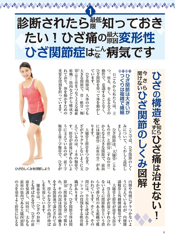 Amazon.co.jp: ひざ痛・変形性膝関節症 整形外科のスーパー