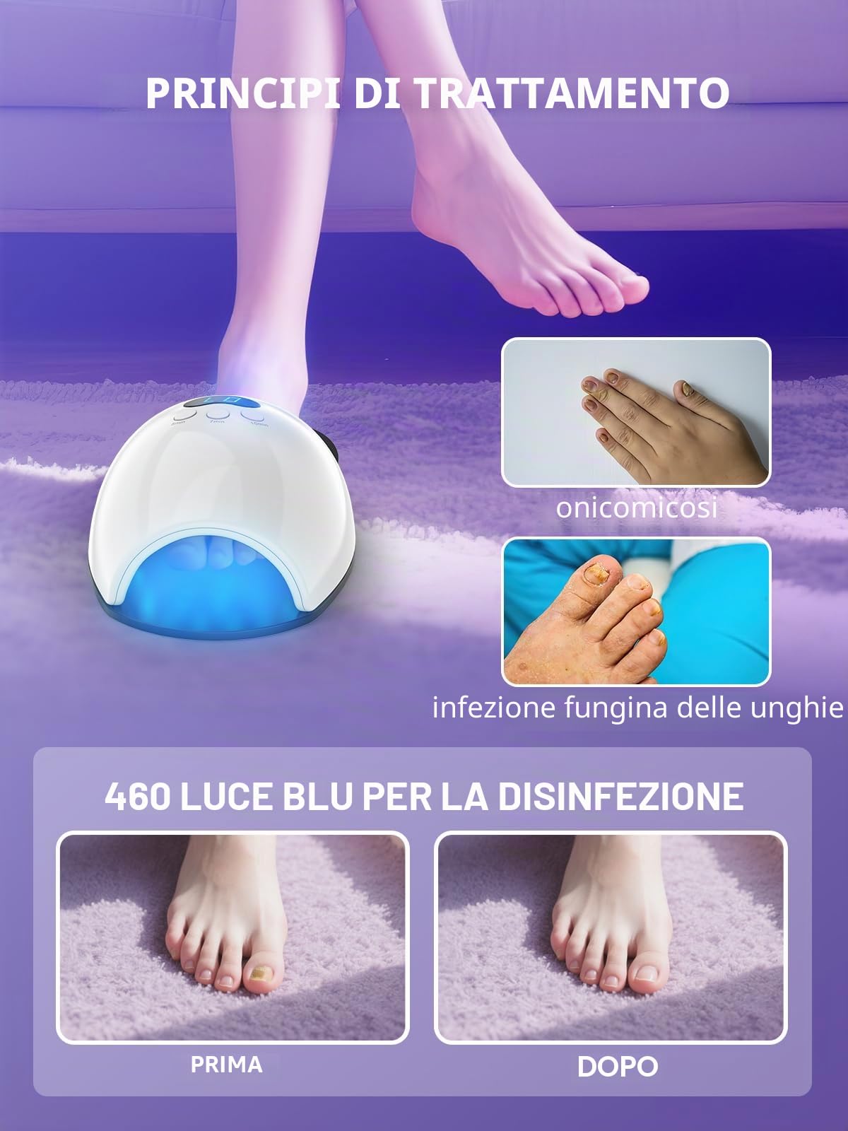 iKeener Aggiornamento laser per funghi delle unghie per dita delle mani e dei piedi, sessioni regolabili 5/7/10 minuti, laser per la pulizia delle unghie e onicomicosi, rimozione funghi delle unghie