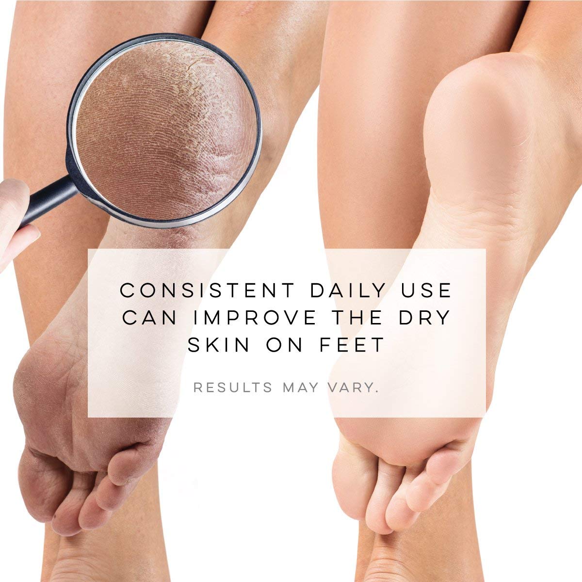 LE EMILIE 5 Toe Moisturizing Gel Socks | Perfect for Healing Dry Cracked Heels and Feet | Infused with Aromatherapy Blend of Lavender and Jojoba Oil | 1 Pair, BLUE : Beauty & Personal Care