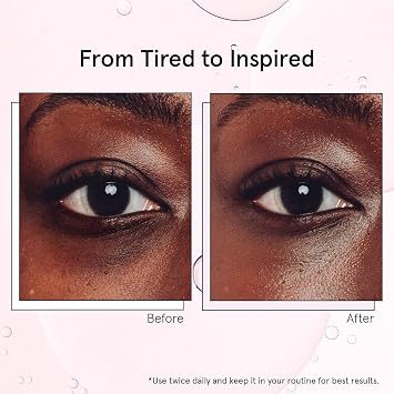 grace & stella Under Eye Brightener with Cooling Metal Rollerball - Centella Asiatica & Caffeine Eye Serum for Puffy Eyes - Travel Essentials - Under Eye Cream - Travel Essentials (15ml / 0.51floz)