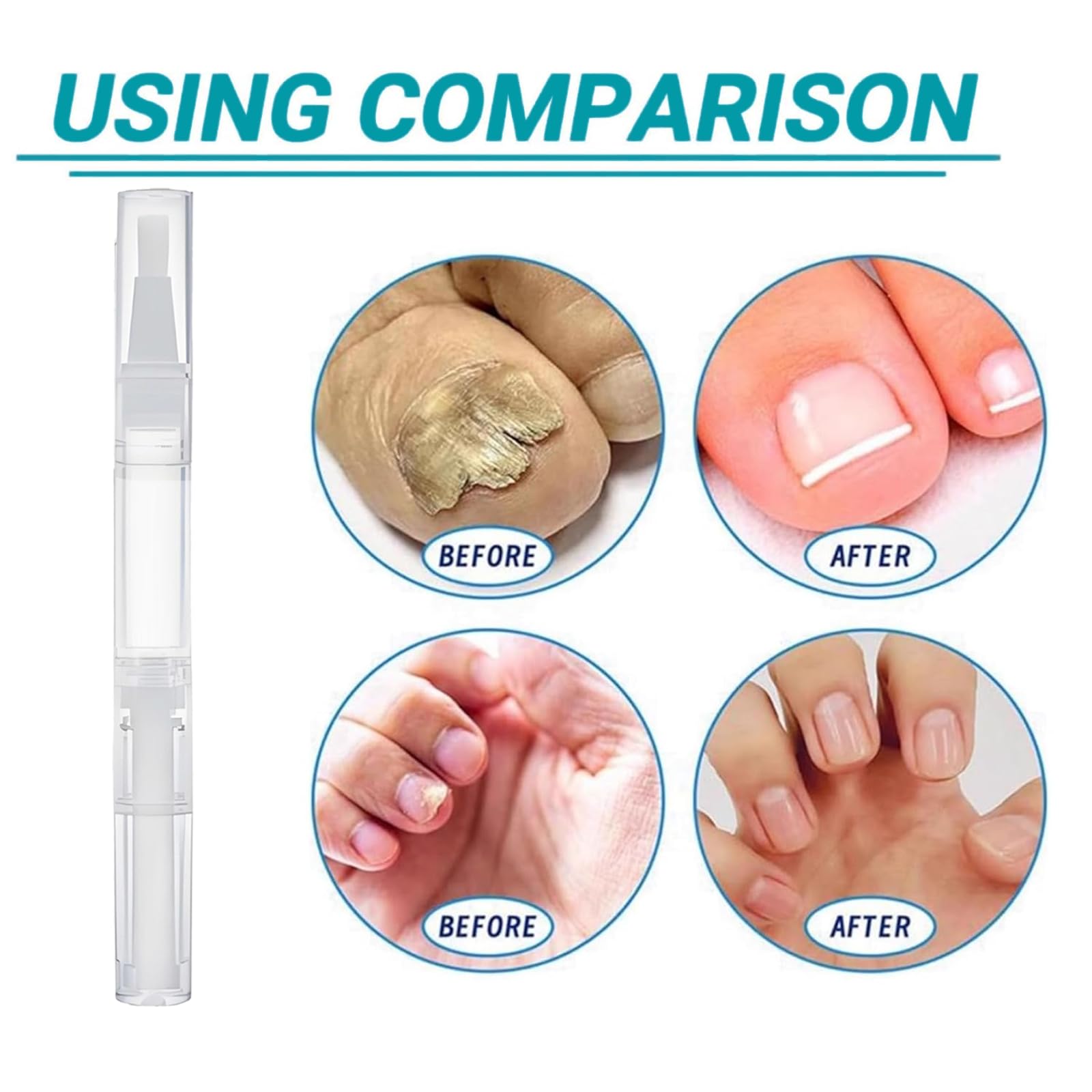 Penna per la cura delle unghie, illumina la superficie del rimuovi cuticole, olio 3 in 1 per unghie secche e danneggiate, amplificatore idratante per unghie sospese, portatile (14 pezzi)