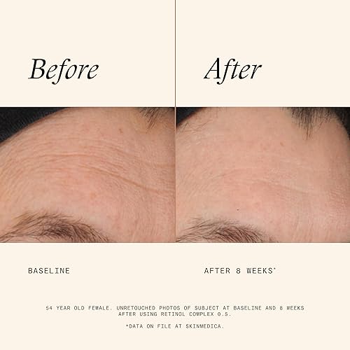 Miniatura 3 de SkinMedica Retinol 05 complejo 1 fl oz