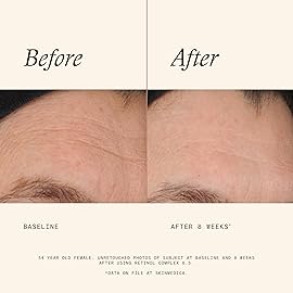 SkinMedica Retinol 0.5 Complex - Retinol Serum for Face, Age-Defying Advanced Retinol Cream That Renews Skin and Diminishes the Appearance of Fine Lines and Wrinkles, 1 Fl Oz