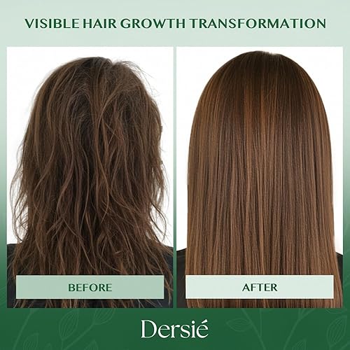 Miniatura 6 de Dersie Batana Oil - Acondicionador para el crecimiento del cabello infundido con aceite de batana y biotina para el crecimiento del cabello, fórmula