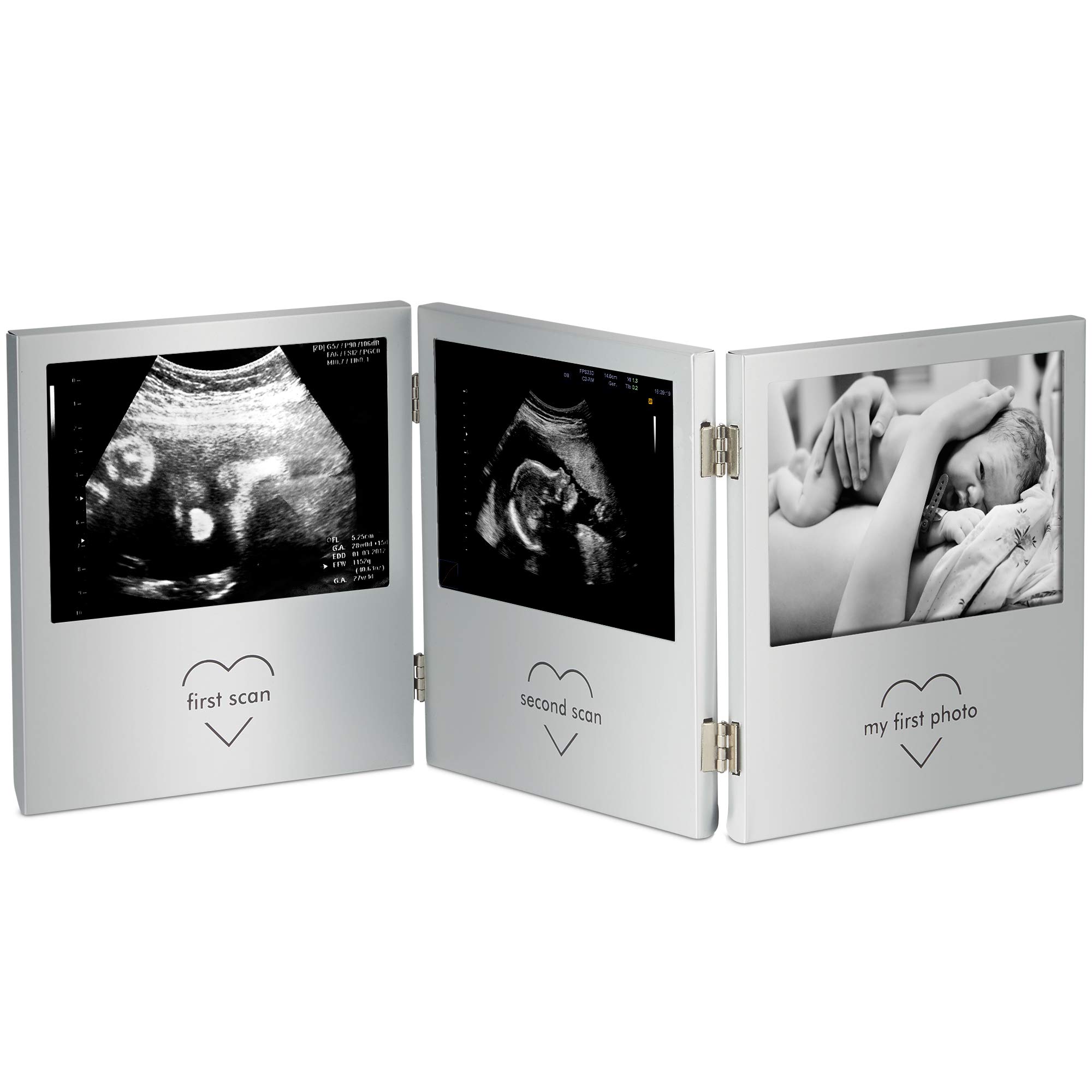 VonHaus Baby Scan Photo Frame for (3x) 5 x 3.5cm Photographs | Aluminium | Triple Hinge | Multi Aperture Collage Picture Display | Personalised Gift Idea for Expecting Mothers, Friends or Family