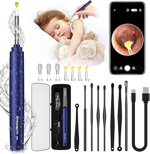 OTAONEOTA Herramienta de eliminación de cera de oído, limpiador de cera de oídos compatible con iPhone, iPad y Android (azul)