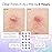 grace & stella Award Winning Pimple Patches for Face - Dermatologist Tested Acne Patches - Hydrocolloid Patch for Breakouts, Whiteheads - Vegan Acne Spot Treatment for Face (Multishape, 144 Count)